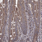 Anti-PDCD6IP Antibody