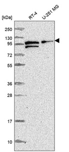 Anti-PDCD6IP Antibody