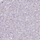 Immunohistochemical staining of human liver shows no positivity in hepatocytes as expected.