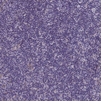 Immunohistochemical staining of human lymph node shows no positivity in non-germinal center cells as expected.