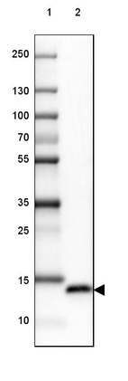 Anti-MSMB Antibody