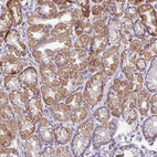 Anti-SMIM11A Antibody