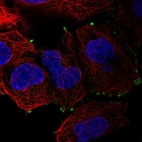 Anti-SMIM11A Antibody