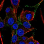 Immunofluorescent staining of human cell line Hep G2 shows localization to plasma membrane.