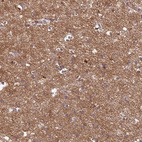 Anti-GABARAPL1 Antibody