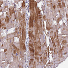 Anti-GABARAPL1 Antibody