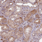 Anti-GABARAPL1 Antibody