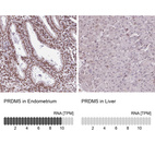 Anti-PRDM5 Antibody