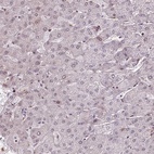 Anti-PRDM5 Antibody