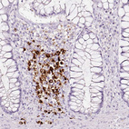 Anti-LAMP3 Antibody