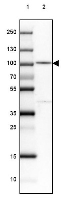 Anti-PDXDC1 Antibody