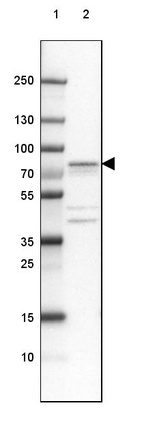 Anti-PDXDC1 Antibody