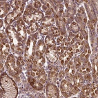 Anti-ZNF513 Antibody