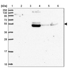 Anti-ZNF513 Antibody