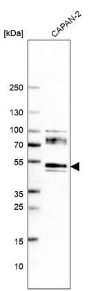 Anti-NPTN Antibody