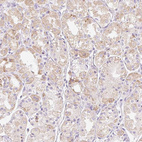 Anti-CLEC3A Antibody