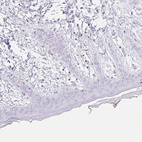 Anti-CLEC3A Antibody