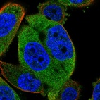 Immunofluorescent staining of human cell line PC-3 shows localization to cytosol.