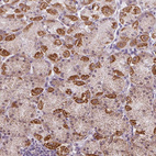 Anti-GPT2 Antibody