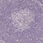 Anti-GPT2 Antibody