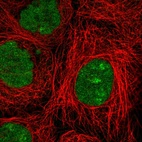 Anti-NSMCE2 Antibody