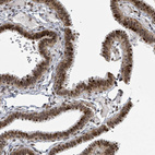 Anti-GTF3C1 Antibody