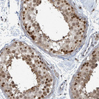 Anti-GTF3C1 Antibody