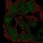 Anti-ZFP82 Antibody