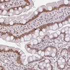 Anti-FAM32A Antibody