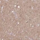 Anti-TLN2 Antibody