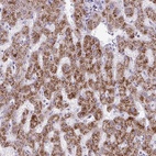 Anti-ANKRD13B Antibody