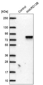 Anti-ANKRD13B Antibody