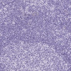 Anti-CKMT2 Antibody