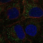 Anti-TDGF1 Antibody