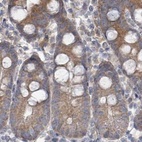 Anti-RPL32 Antibody