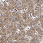 Anti-RPL32 Antibody