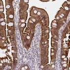 Anti-DAB1 Antibody