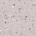 Anti-HDAC3 Antibody