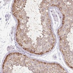 Anti-MAGEC3 Antibody