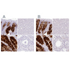 Immunohistochemical staining of human colon, liver, rectum and testis using Anti-ZG16 antibody HPA052066 (A) shows similar protein distribution across tissues to independent antibody HPA052512 (B).