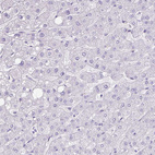 Immunohistochemical staining of human liver shows no positivity in hepatocytes as expected.