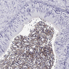 Anti-QRICH2 Antibody