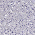 Anti-QRICH2 Antibody