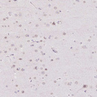 Anti-TBX15 Antibody