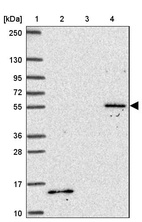 Anti-TBX15 Antibody