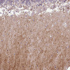 Anti-CMTM5 Antibody