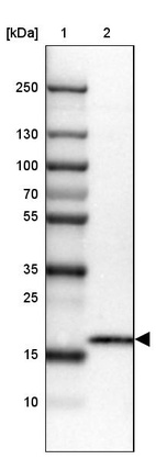 Anti-CMTM5 Antibody