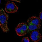 Anti-CMTM5 Antibody