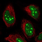 Anti-POLR1E Antibody