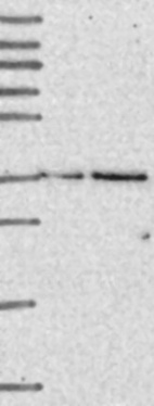 Anti-ELP5 Antibody